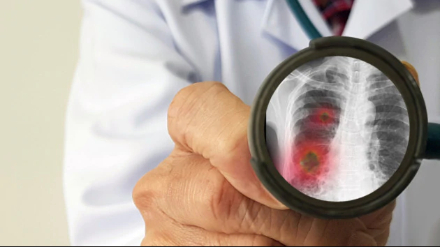 Coronavirus: identificato un possibile farmaco