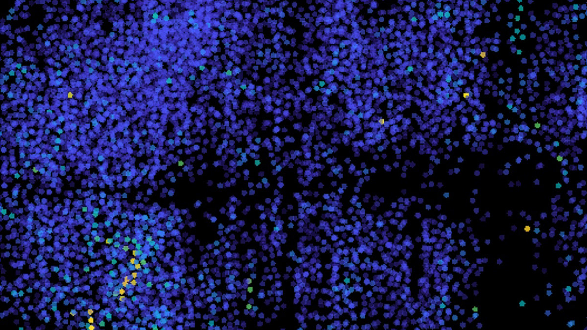 Immagine della microscopia ad alta velocità dell’attività neuronale nel cervello di un pesce zebra